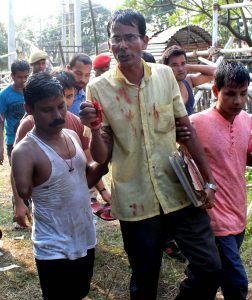 Injured person carry to hospital during Police lathi charge at Pratibandhi Suraksha Sangstha protest their demand at Dispur Last Gate in Guwahati on 05-10-18. Pix BY UB Photos