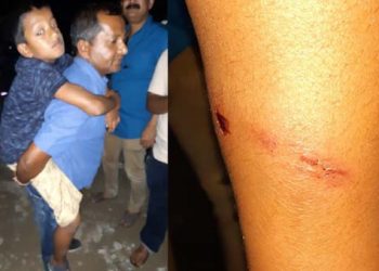 শিৱসাগৰ শংকৰদেৱ শিশু নিকেতনৰ ছাত্ৰক শিক্ষকৰ নিৰ্মম প্ৰহাৰ