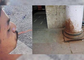 পিক পেলাওঁতে সাৱধান হওক মহানগৰবাসী : আপুনি এতিয়া নিৰীক্ষণত আছে, ভৰিব লাগিব জৰিমনা