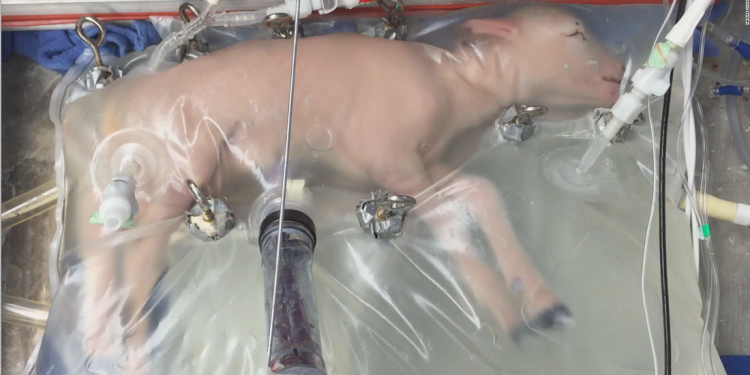 Artificial womb: No longer a distant dream?