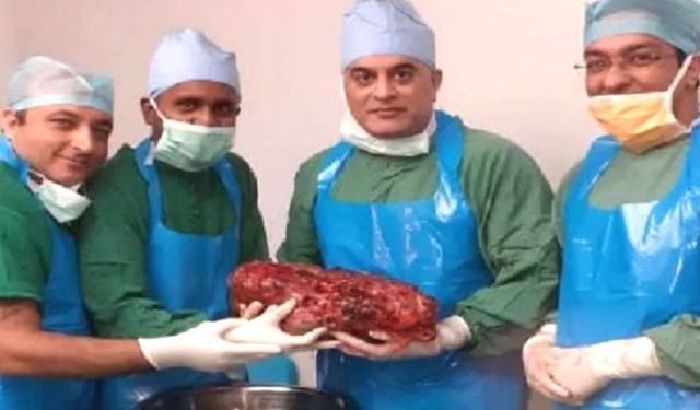 kidney_1574749247