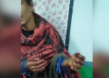 Injured-villager-