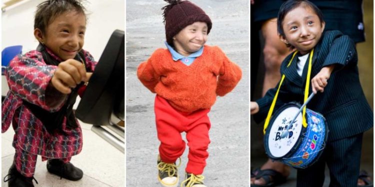 WORLDS-SHORTEST-MAN-COLLAGE-1 copy_tcm25-606517