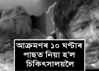 নিষ্ঠুৰ মহানগৰ! ১০ ঘণ্টা ধৰি পদপথত ৰক্তাক্ত অৱস্থাত পৰি ৰ’ল দুজন লোক
