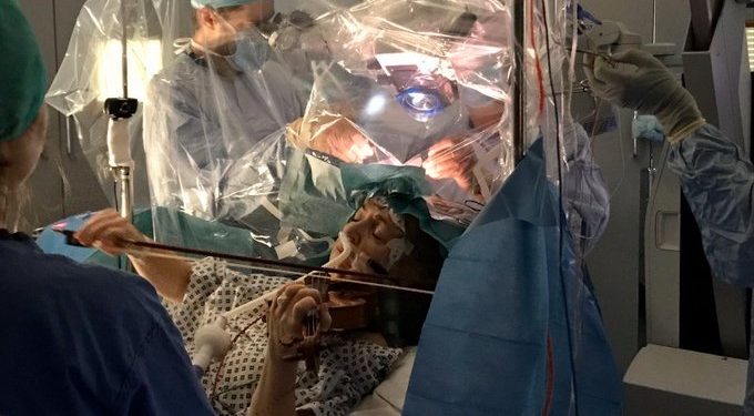 Patient plays violin while surgeons remove brain tumour in London's King's College Hospital