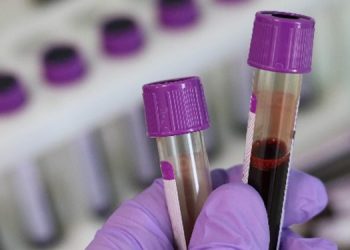 People with this blood group most vulnerable to coronavirus!