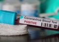 COVID19-positive-case.-Image-credit-ddnews.gov_.in_-1140x570