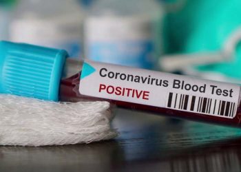 COVID19-positive-case.-Image-credit-ddnews.gov_.in_-1140x570