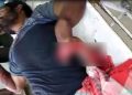 ল’কডাউনৰ মাজতে ধুবুৰীত বৰফৰ ফেক্টৰীত বিস্ফোৰণ; আহত তিনিজন শ্ৰমিক