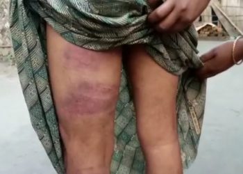 বঙাইগাঁৱৰ কোকিলাত গৰু চোৰ সজাই মানসিকভাৱে বিকাৰগ্ৰস্ত যুৱকক প্ৰহাৰ