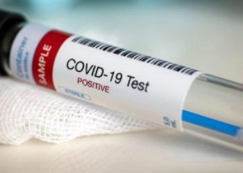 102 persons test COVID-19 positive in Tripura