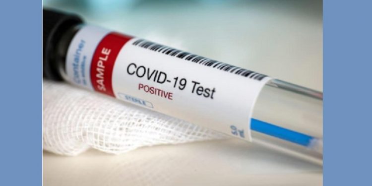 102 persons test COVID-19 positive in Tripura