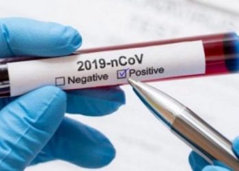 COVID19-positive-1-1140x570-750x375-1