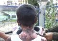 Assam: Dibrugarh doctor who poured boiling water on minor absconding