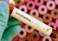 336 persons test Covid19 positive in Assam on Saturday