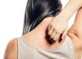 Mosquito bite women