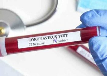 Coronavirus-Test-