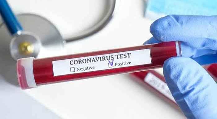 Coronavirus-Test-