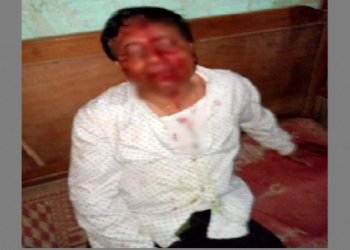 congress leader attack in Khumtai