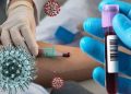 plasma-therapy