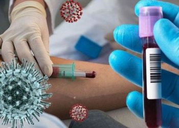 plasma-therapy
