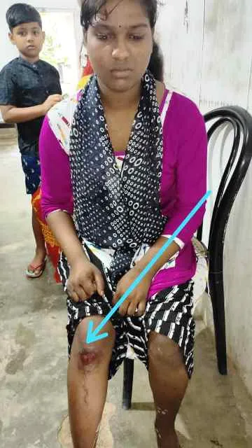 ab