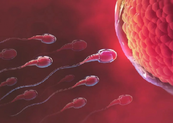 male infertility