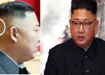 Kim jung un