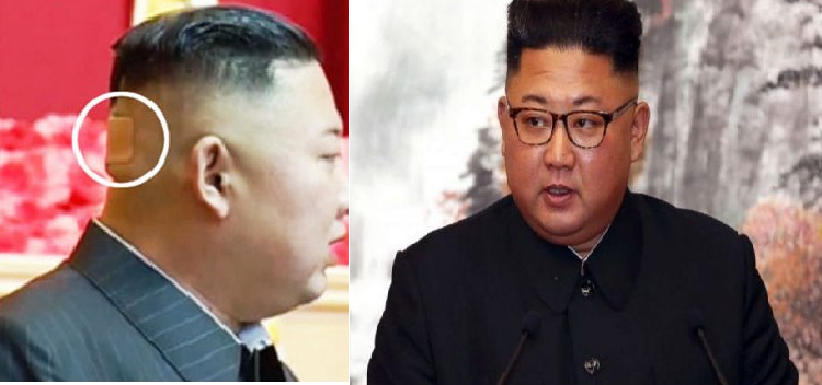 Kim jung un