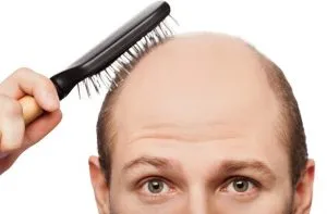 balding_man