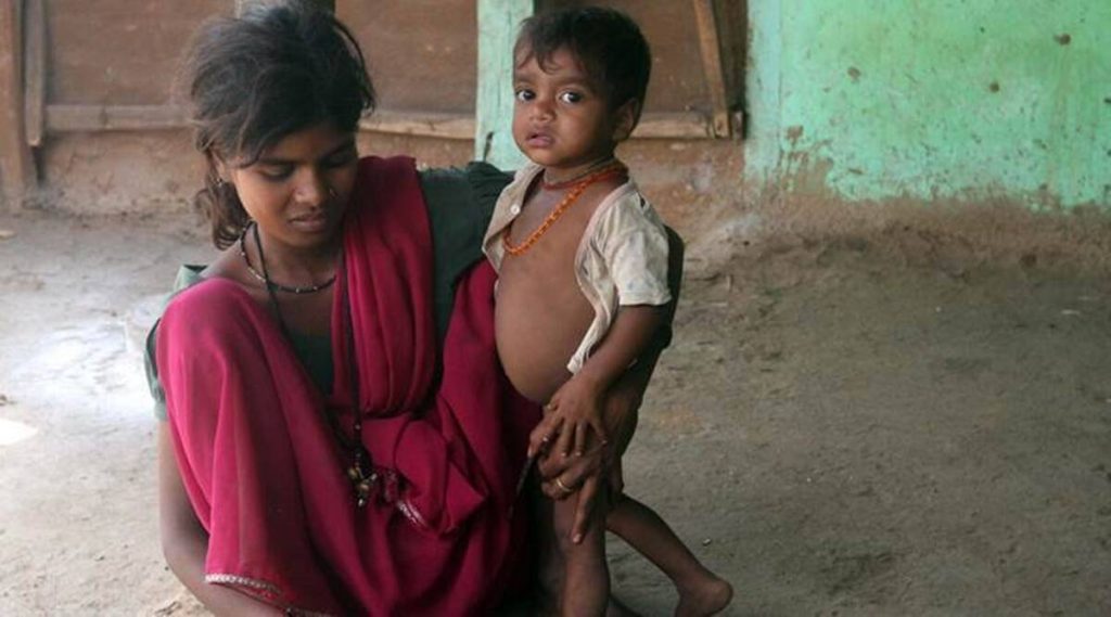 Global Hunger Index 2021 reflects India’s reality