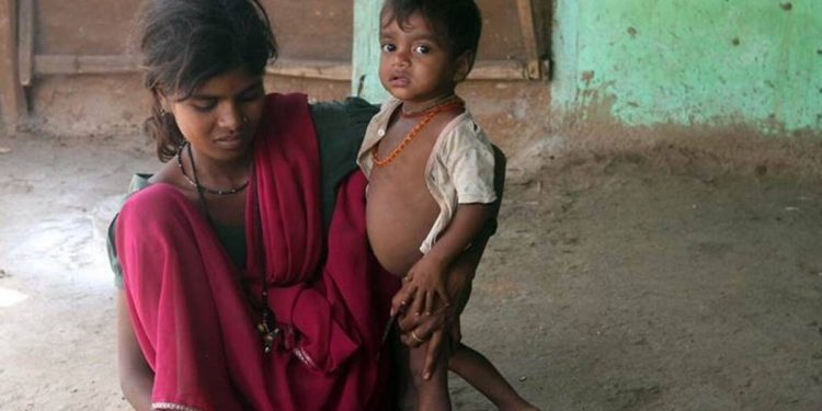 Global Hunger Index 2021 reflects India’s reality
