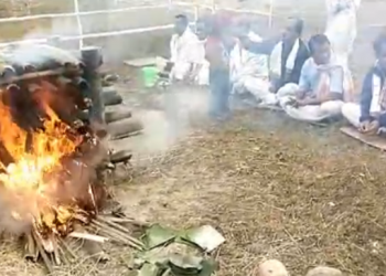 Meji burns
