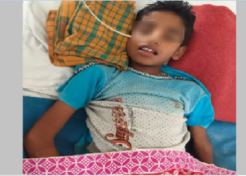 বঙাইগাঁৱত ‘ব্ৰেইন টিবি’ ৰোগত আক্ৰান্ত চতুৰ্থ শ্ৰেণীৰ ছাত্ৰ ৰোহিত