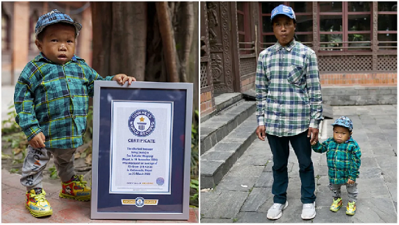 World's Shortest Adolescent
