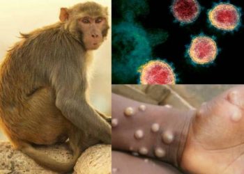 Monkey pox আমেৰিকাত ধৰা পৰিল মাংকি পক্সৰ প্ৰথমটো ঘটনা,কি এই মাংকি পক্স?