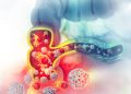 Cancer treatment
