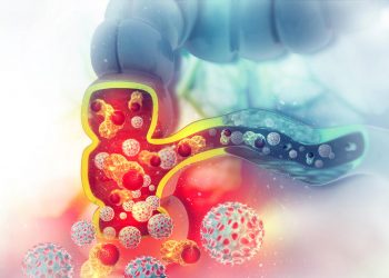 Cancer treatment