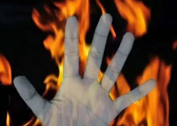 নাবালিকাক ধৰ্ষণ কৰাৰ অভিযোগত গাওঁবাসীয়ে কেৰাচিন ঢালি জ্বলাই দিলে দুই যুৱকক