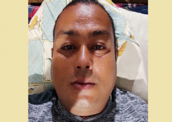 বন্য জন্তুৰ বেহাঃ পুনৰ জামিন নাকচ বন বিষয়া অৰূপ বৈশ্যৰ