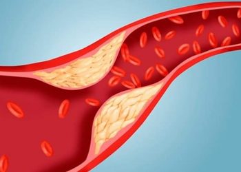 Cholesterol: কলেষ্টেৰল বুলি ক’লেই বৰ চিন্তা হয় নহয় জানো?  আহকচোন কলেষ্টেৰল কিয় হয় আৰু তাৰ চিকিৎসাৰ বিষয়ে জানো