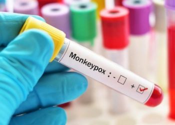 Monkeypox: দিল্লীত মাংকিপক্সত আক্ৰান্ত নাইজেৰিয়াৰ ব্যক্তি; দেশত আক্ৰান্তৰ সংখ্যা ৬জনলৈ বৃদ্ধি