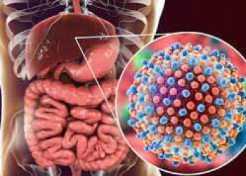 Hepatitis B