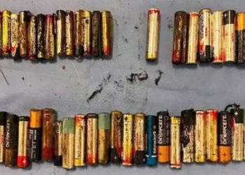 মহিলাৰ পেটৰ পৰা এটা এটাকৈ উলিয়াই অনা হ’ল ৫৫ টা বেটাৰী; চকু কপালত উঠিল চিকিৎসকৰ!