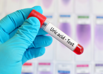 Uric Acid