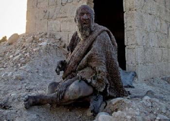 World's dirtiest man