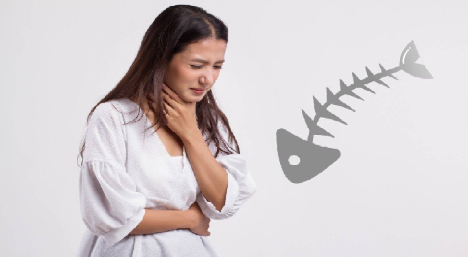 fish thorn in throat