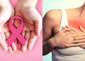 breast cancer