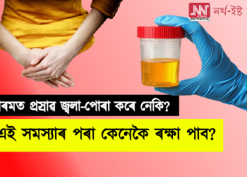 গৰমত প্ৰস্ৰাৱ জ্বলা-পোৰা কৰে নেকি? এই সমস্যাৰ পৰা কেনেকৈ ৰক্ষা পাব?