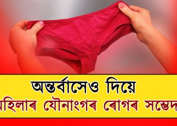অন্তৰ্বাসৰ স্ৰাৱৰ ৰঙে যৌনাংগৰ ৰোগক নিৰ্দেশ কৰে নেকি? জানিবলৈ চাওক…